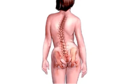 As razóns para o desenvolvemento da osteocondrose cervical
