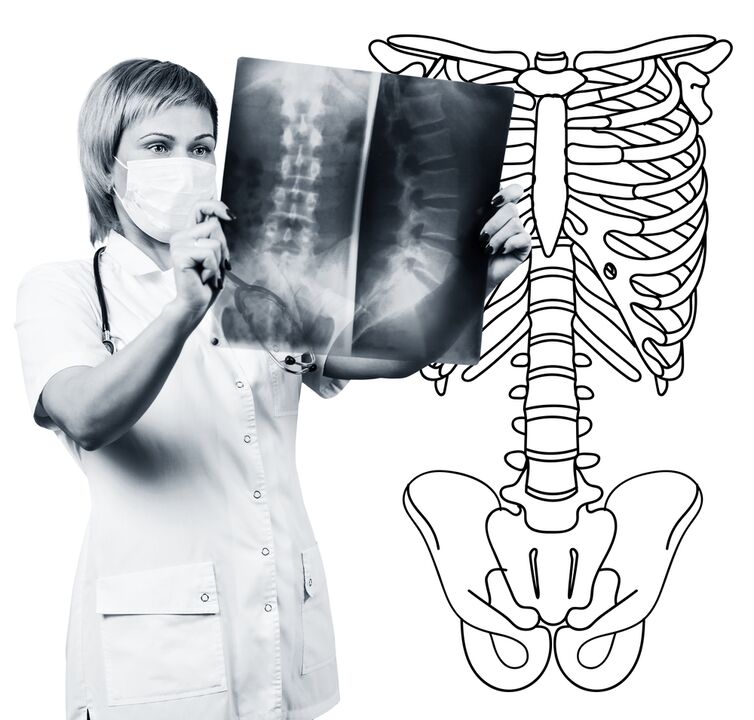 Radiografía da columna vertebral lumbar